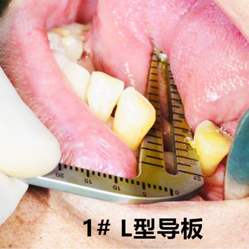 Dental Implant Guide Set Oral Planting Locator Positioning Guide Drilling Positioning Ruler Angle Ruler Implant Tools Dentist