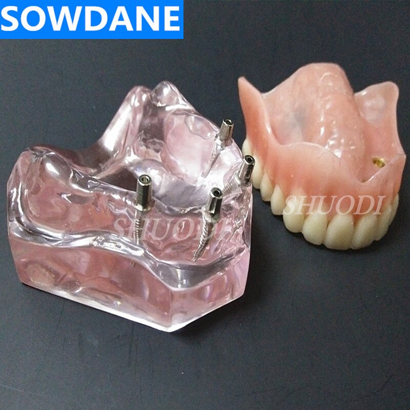 Prothèse Dentaire Complète Supérieure - Fausses Dents Neuves, Générique