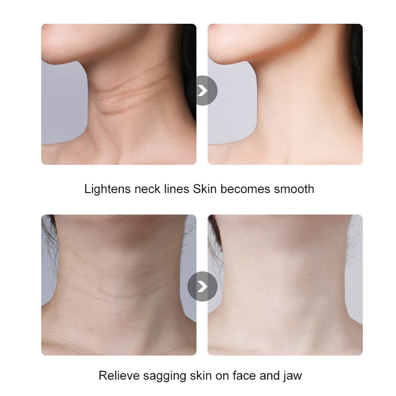 AmazeFan-masajeador de cuello Facial Led, 3 colores, fotonterapia, máquina de eliminación de arrugas de cara y cuello, Reduce el estiramiento de piel de doble barbilla