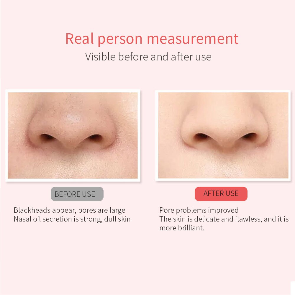 Vibrate Deep Face Cleaning Skin Scrubber Deep Face Cleaning Machine Peeling Shovel Facial Pore Cleaner Face Skin Scrubber