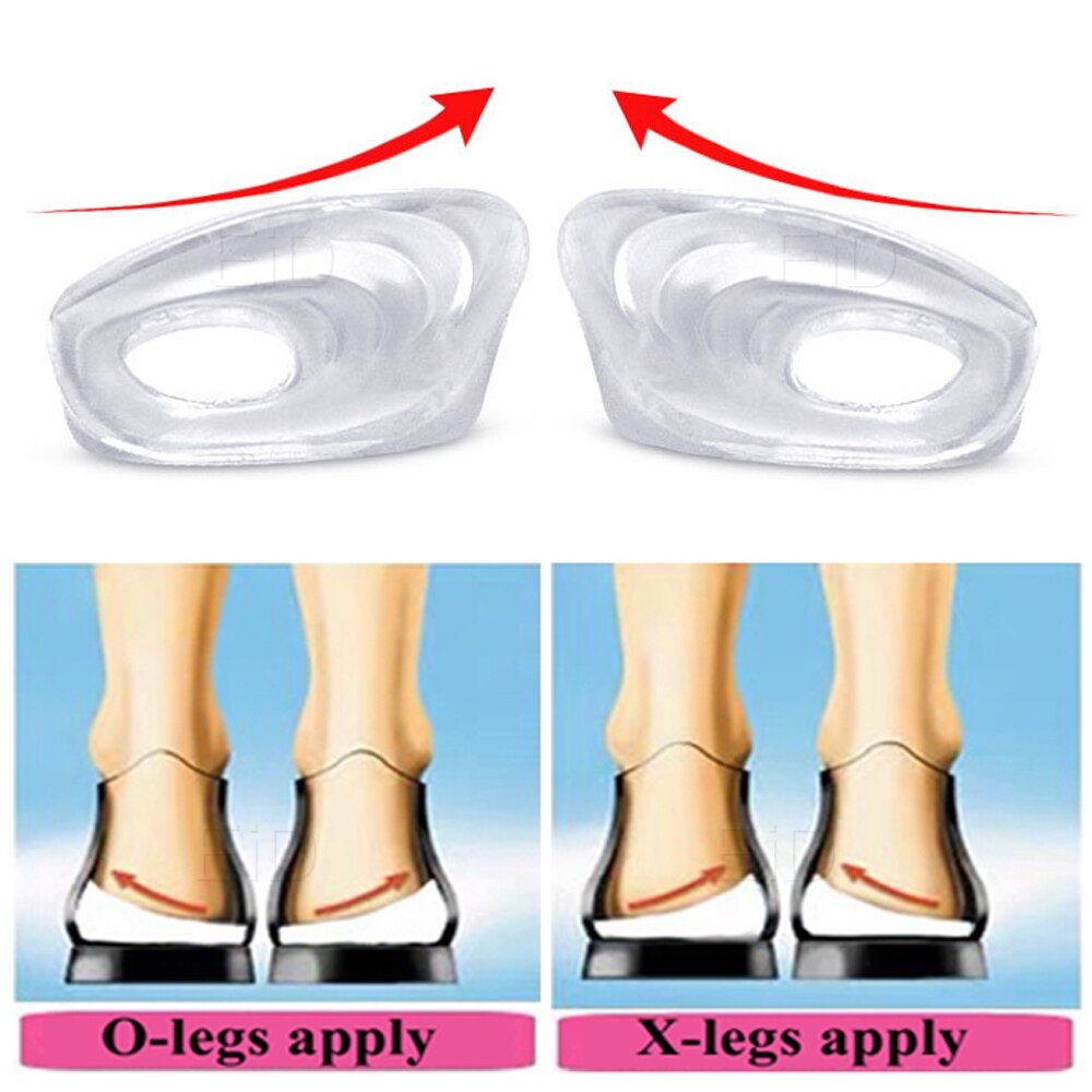 Semelles orthopédiques en gel de silicone pour pieds plats, semelles de chaussures à soutien de voûte plantaire élevé, coussin orthopédique pour la correction, santé des jambes de bœuf, soins des pieds