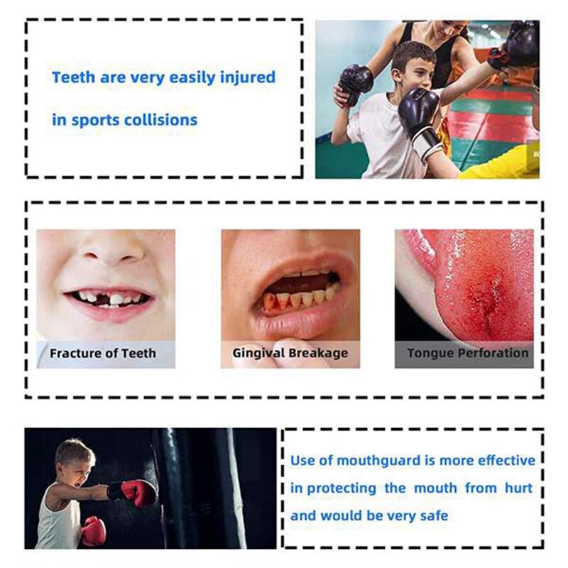 NEW-4 Pack calcio protezione della bocca, calcio protezione della bocca per adulti e giovani, sport per la bocca per Hockey, basket, MMA