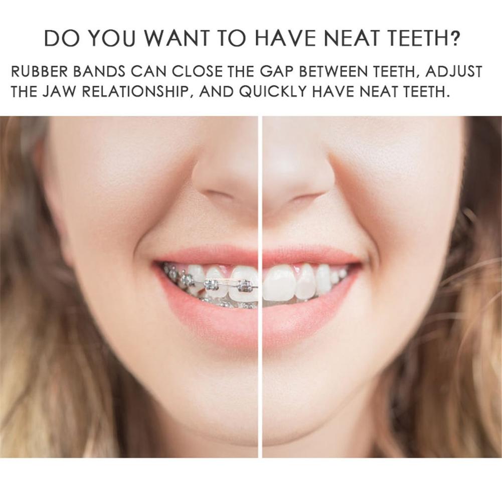 100pcs Dental Materials Disposable Rubber Ring 6.35mm Ligation Ring