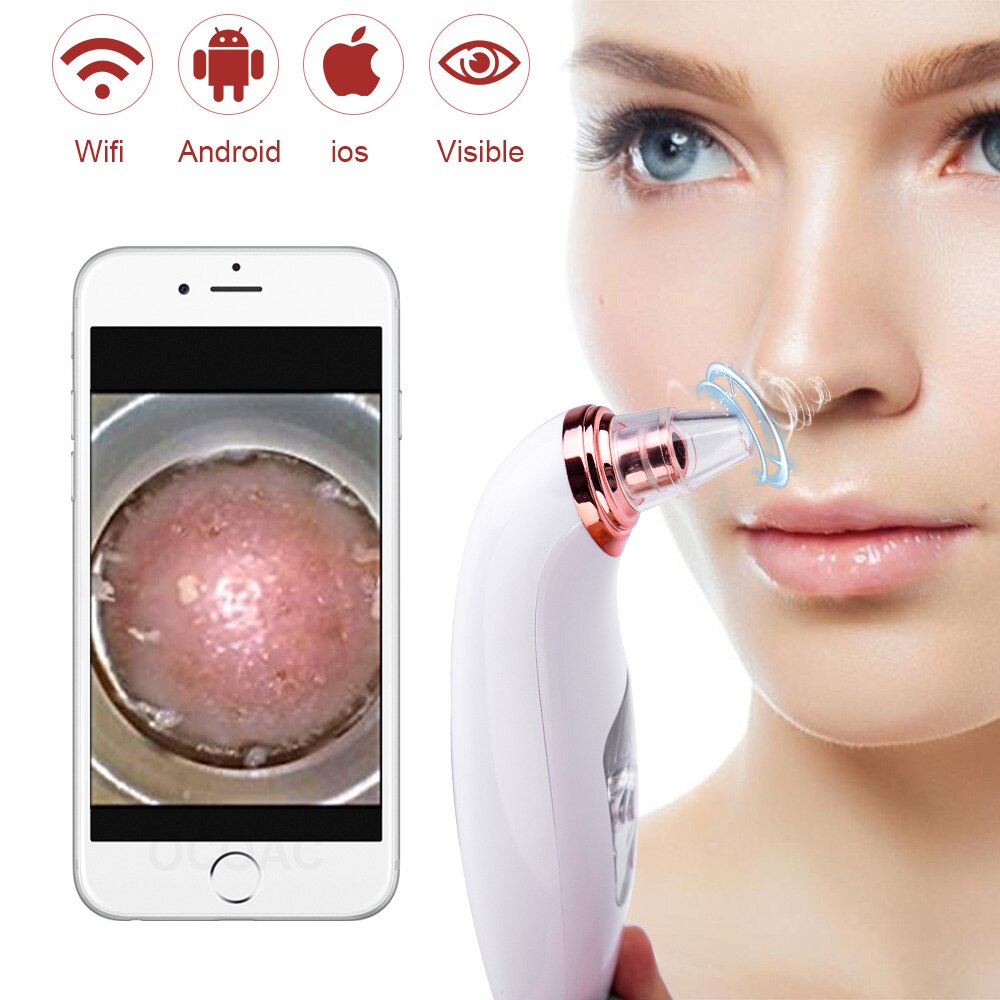 Visible Camera Blackhead Remover for D**a