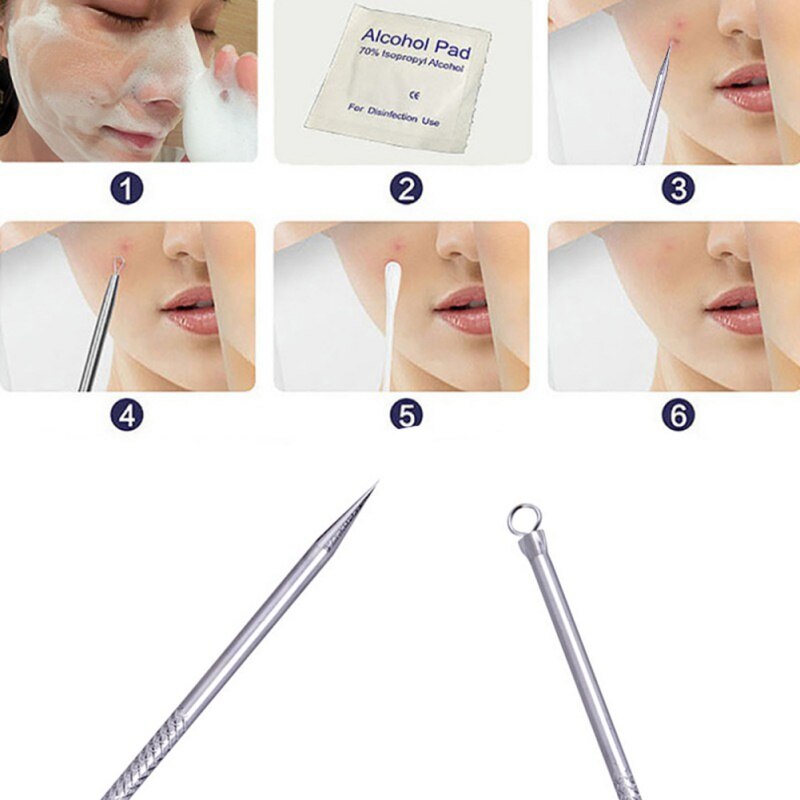 5pcs blackhead comedone acne pimple blemish extractor,vacuum blackhead remover,acne/blackhead extractor tool for face