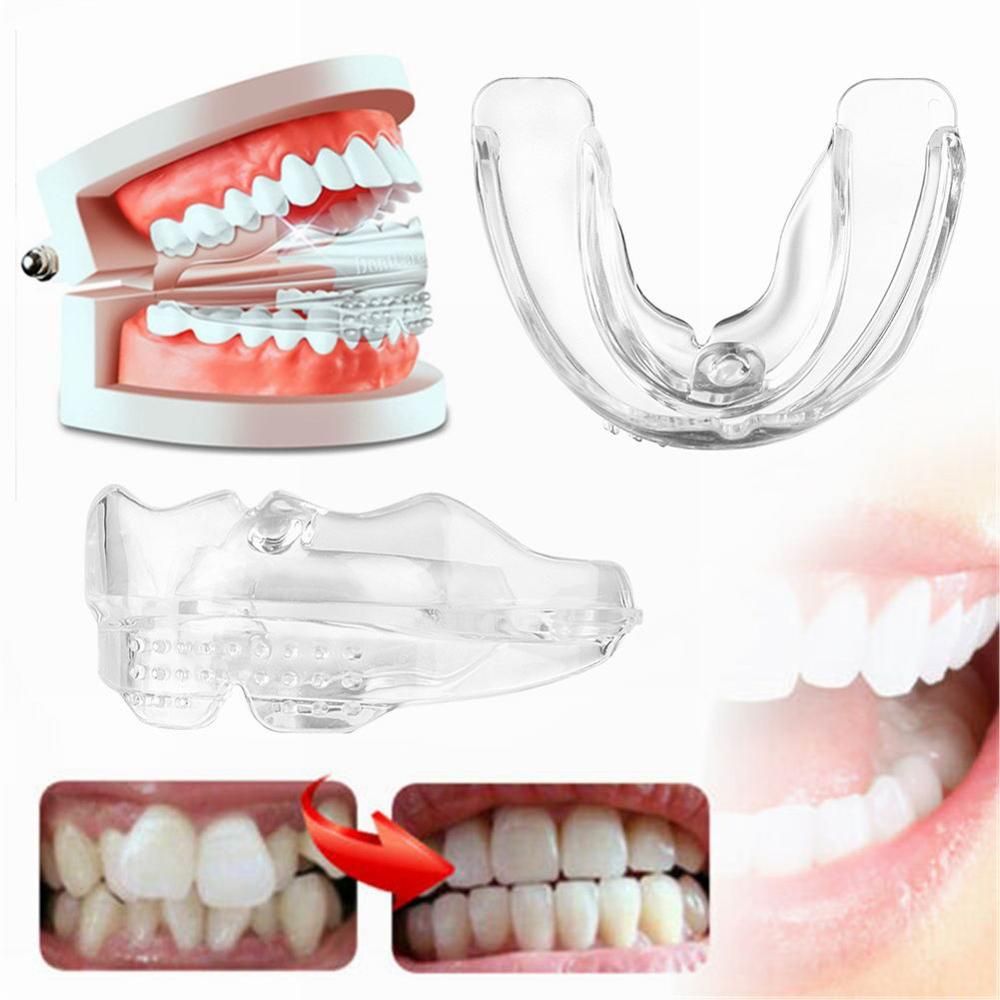 Transparante Orthodontische Beugels Beugels Instan... – Vicedeal