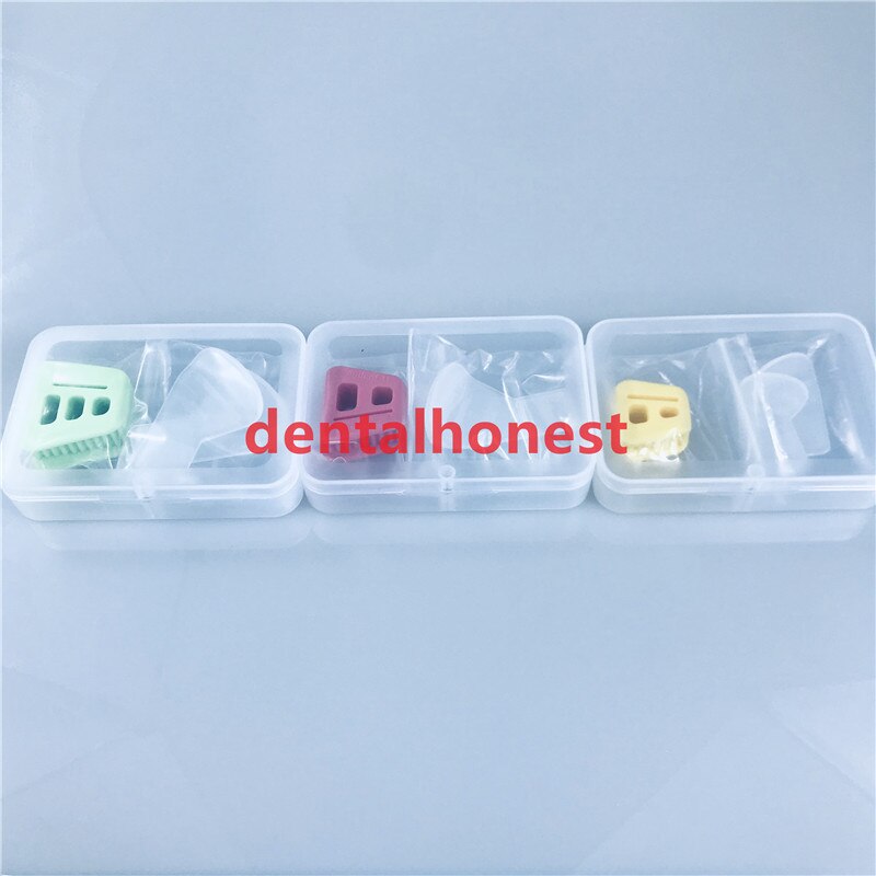 Zahn Retractor Mund Öffner Silikon Gummi Mund Öffner Zurückhalten zunge für Wange Retractor Zahnspange