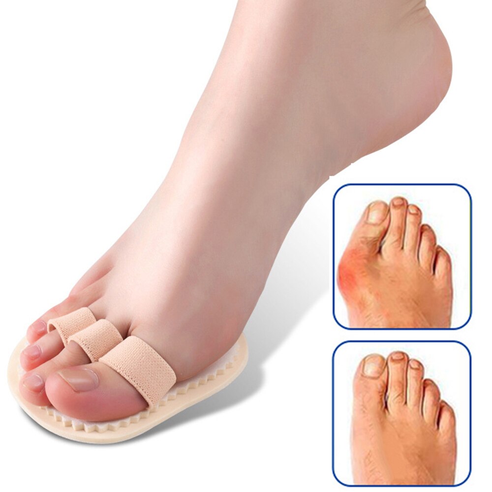 1pc hamerteen rechtmaker, hallux valgus beschermer, teencorrector, voetbot, duimversteller, teenspreider