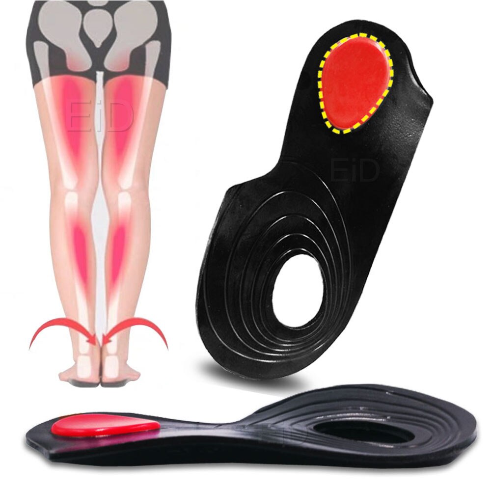 OX Leg Orthotics Cubitus Varus half flat foot Insole Orthopedic Insoles for Shoes insert Arch Support pad for plantar fasciitis