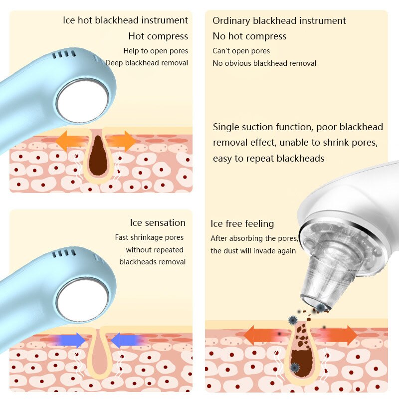 5 Level Pro Vacuum Pore Cleaner Blackhead Remover Cold Electric Strong Suction Pore Vacuum for Nose Face blackhead remover