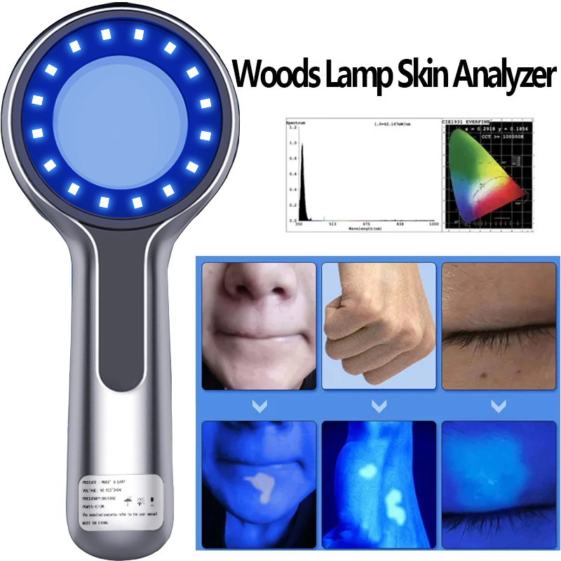 Woods Lamp Skin Analyzer For Skin UV Magnifying For Beauty Facial Testing Wood Lamp Light Skin Analysis Detection Skin Care