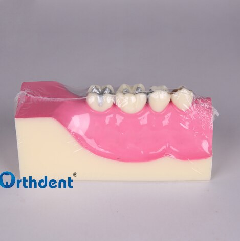 Dental Disease Teeth Anatomy Study Model Molar Cross Section Model