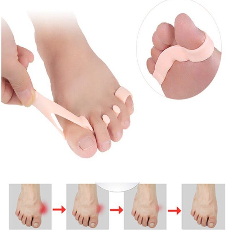 Hallux Valgus Orthotics Bunion Splint for Separate All Toe Big Bone Orthopedic Foot Hammer Corrector Separator Inserts Pad