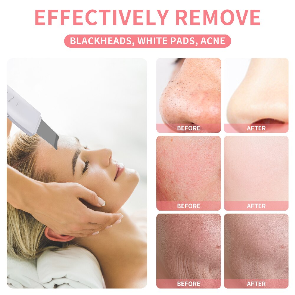 Ultrasonic Skin Scrubber Peeling Face Spatula Blackhead Remover Facial Scrubber Shovel Clean Cavitation Peeling Facial Lifting