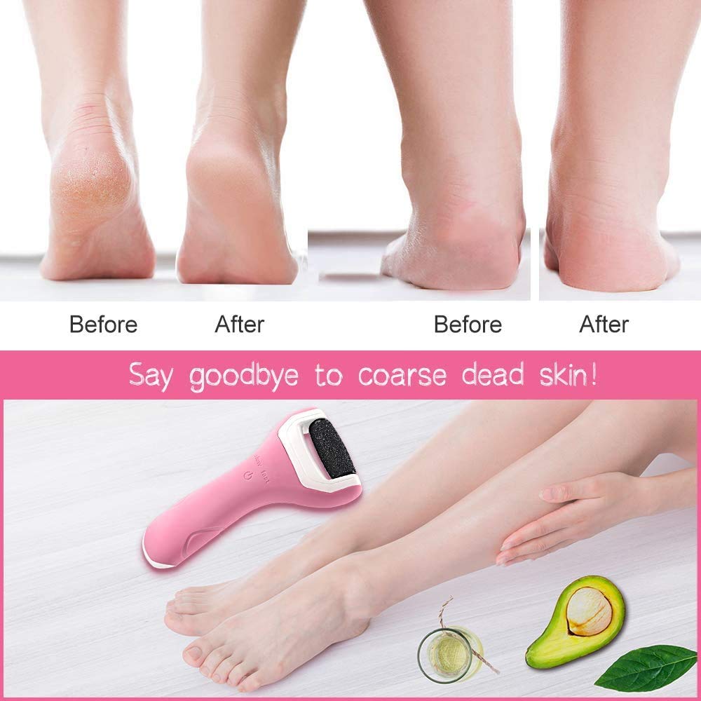 Foot File Electric Hard Skin Remover Foot Pedicure Callus Remover USB Rechargeable Foot Care Tool with 2 Roller Heads
