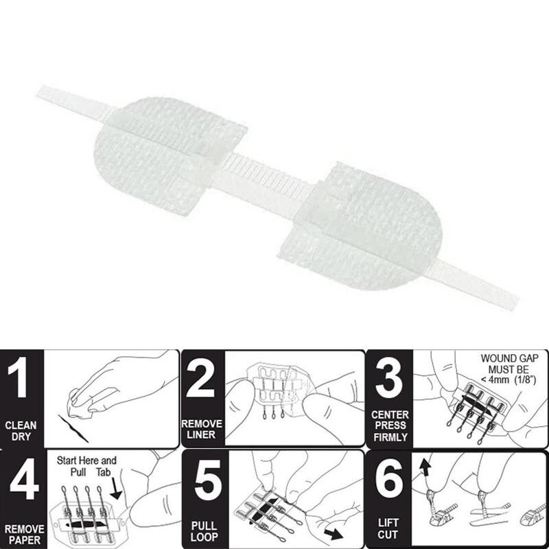 3 Stks/zak Fda Gecertificeerd Rits Pleister Outdoor Geen-Naaien Quick Wond Dressing Hechtdraad Tape Bandage Hechtdraad-gratis Zip Band-Aids Tool