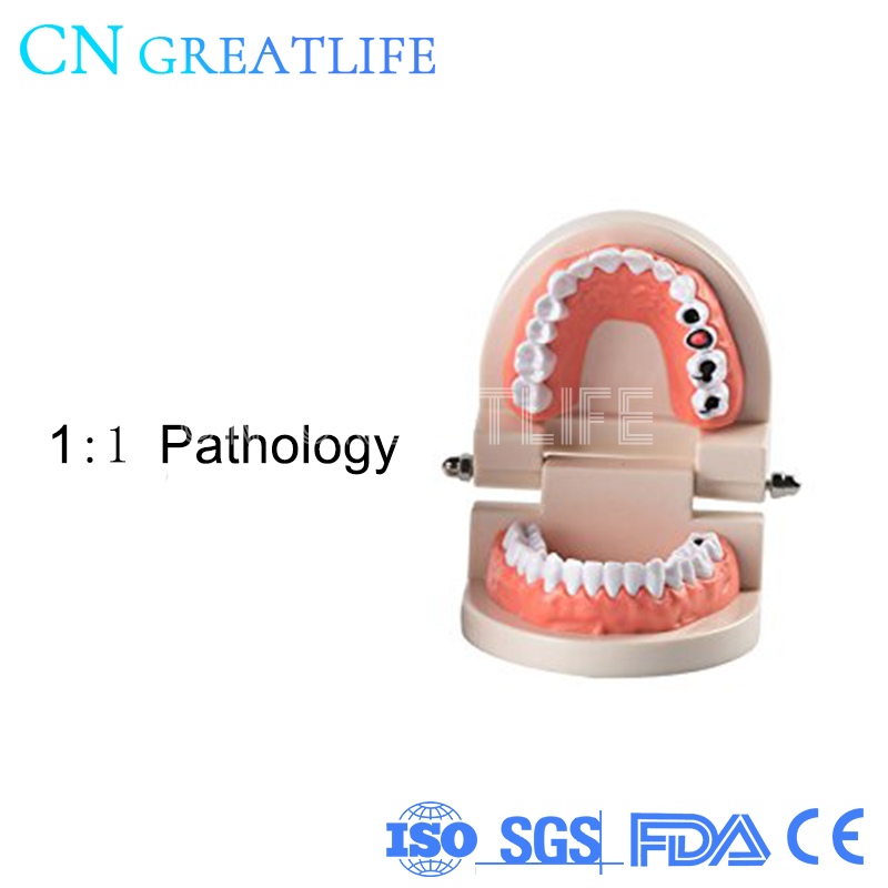 Good Typodont Teeth Model Practical False Dental Teeth Model Teeth Model for Studying