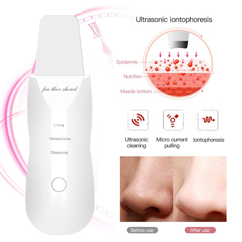 Beauty Star-limpiador Facial ultrasónico, limpiador Facial ultrasónico para limpieza de la piel, exfoliante, eliminación de espinillas, limpiador de poros, depurador Facial