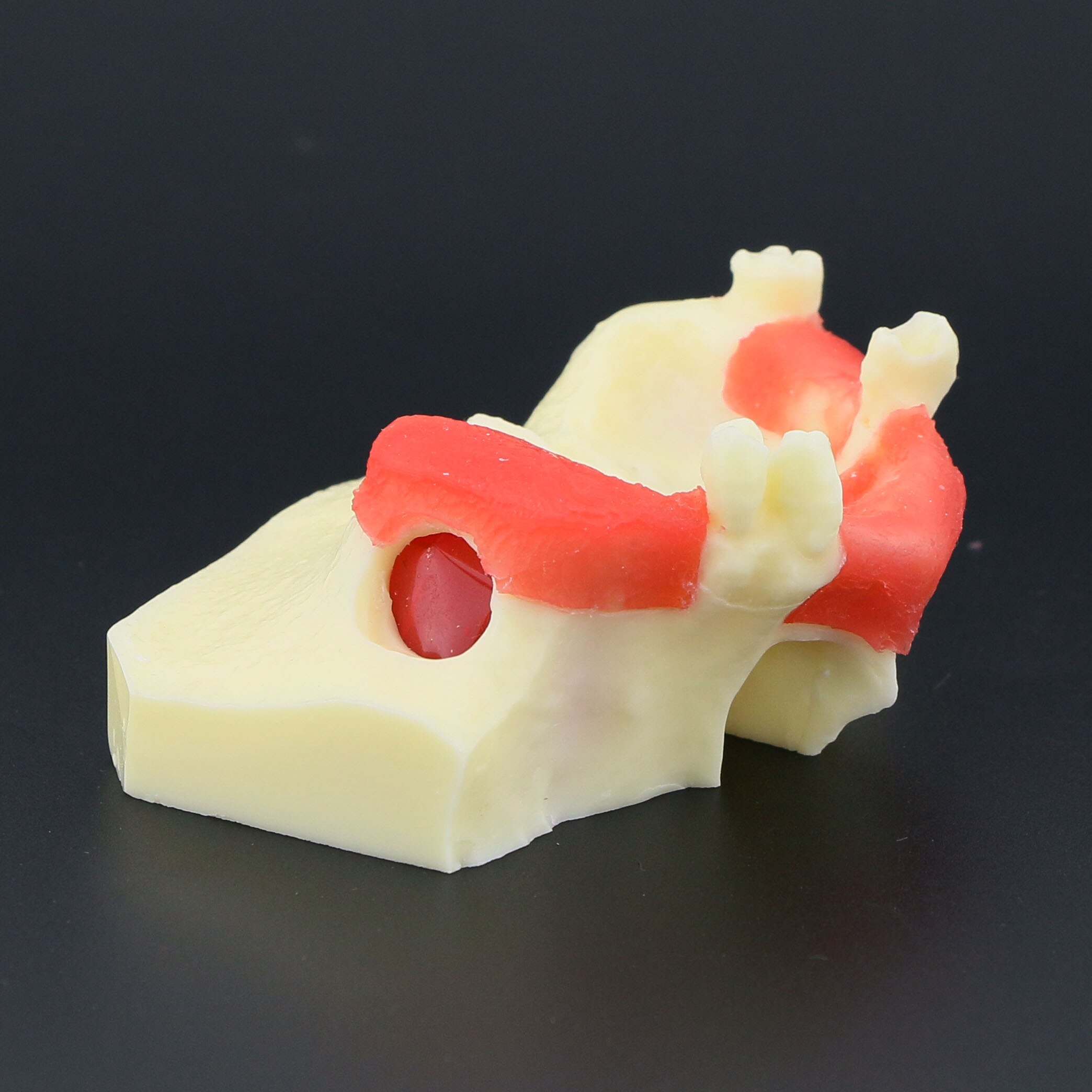 Dental Implant Teeth Model M2012 Typodont Maxillary Sinus Lift Practice Model Resin Tooth Demo For Teaching Study