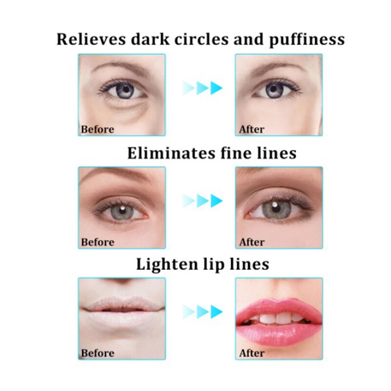 Appareil de Massage des yeux électrique lèvre masseur du visage enlèvement cercle foncé élimination des poches Vibration mince visage Anti-rides (rose)