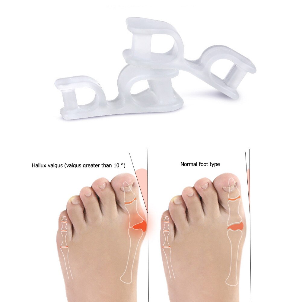 Klassieke Sebs Teen Separator Praktische Duurzaam Multi-Functionele Bunion Hallux Valgus Spalk Orthese Overlappende Protector