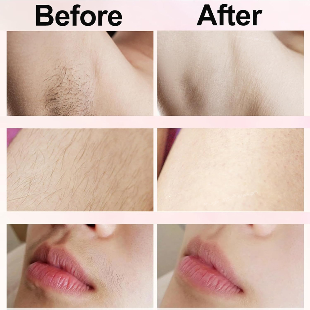 Rasoir électrique femme rasoir indolore femmes moustache épilateur Bikini jambe corps tondeuse pour femmes épilateur Facial épilateur