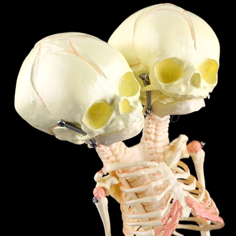 Human Double Head Baby Skull Research Model Skeleton Anatomical Brain Anatomy Teaching Study Display