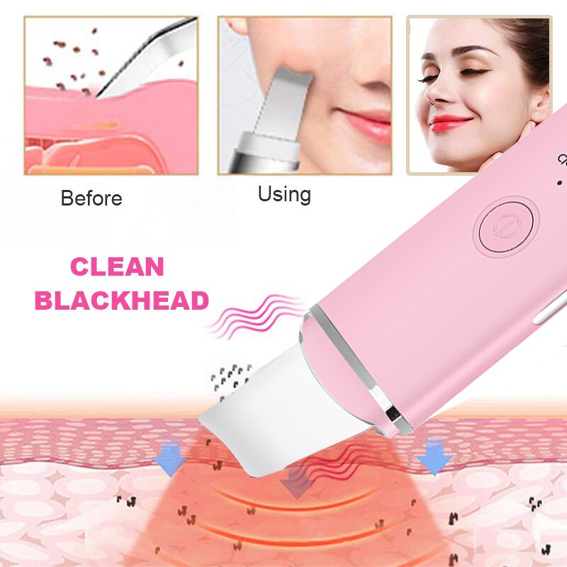 Ultrasonic Skin Scrubber Vibration Face Spatula Blackhead Remover Facial Scrubber Shovel Clean Cavitation Peeling Facial Lifting