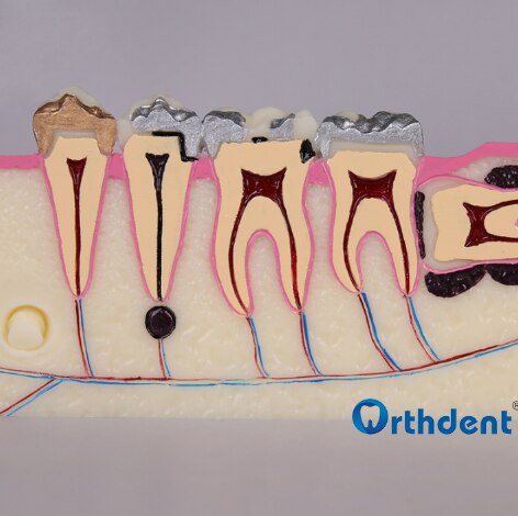Dental Disease Teeth Anatomy Study Model Molar Cross Section Model