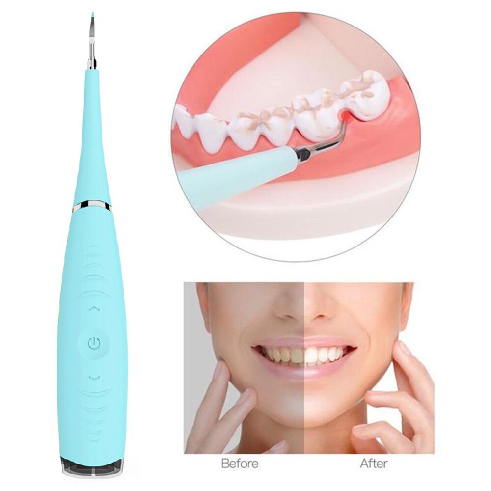 Tandheelkundige Ultrasound Tanden Reinigen Tandsteen Verwijderen Calculus Remover Tanden Whitening Ultrasone Tand Cleaner Monddouche Voor Tanden