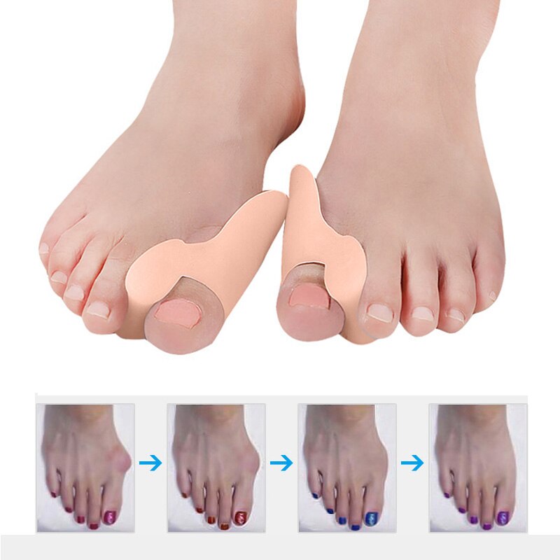 Corrector ortopédico para juanetes, separador de dedos del pie, almohadilla de corrección, herramienta para el cuidado del antepié, 1-4 pares