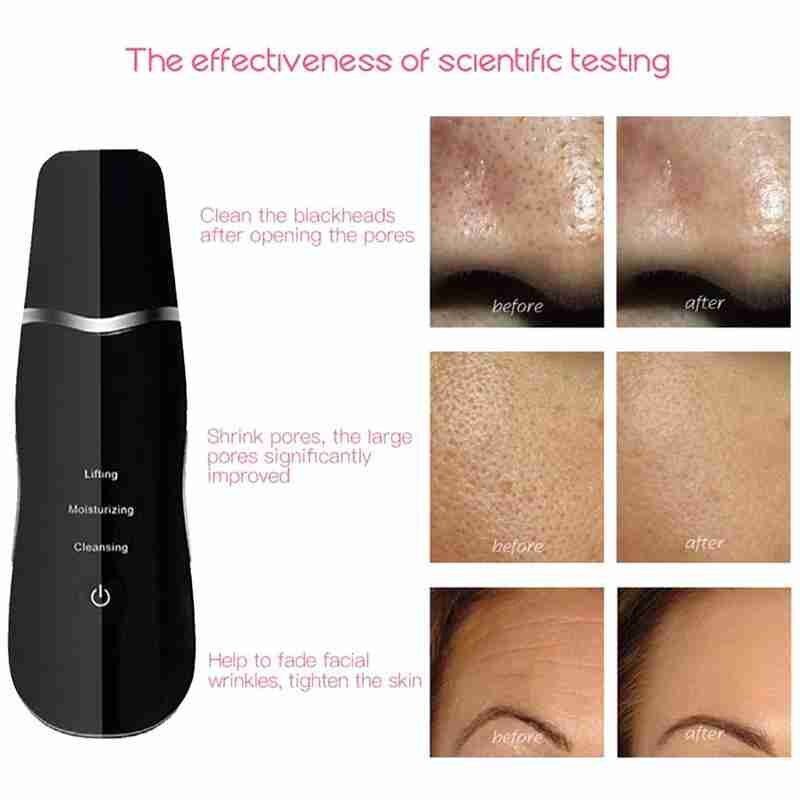 Ultraschall Gesicht Haut Wäscher Reiniger Peeling Vibration Mitesser Entfernung Peeling Poren Reiniger Werkzeuge Wiederaufladbare