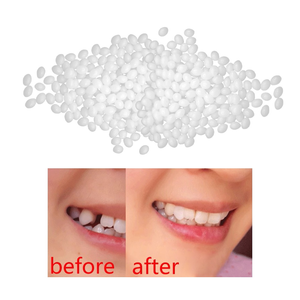 10/50/100g Temporäbetreffend Zahn Ersatz Material Zahn Füllung Temp Ersetzen Fehlende Prothese Klebstoff DIY Zähne Reparatur Zahn