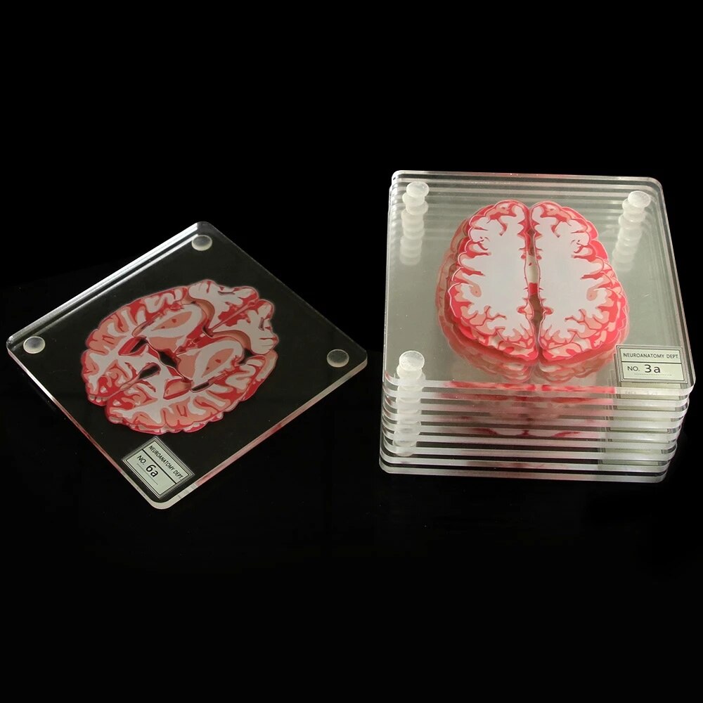 Brain Specimen Coasters Set 3D Organ Brain Artwork Brain Slices Square Acrylic Glass Drinks Table Coaster Drunk Scientists