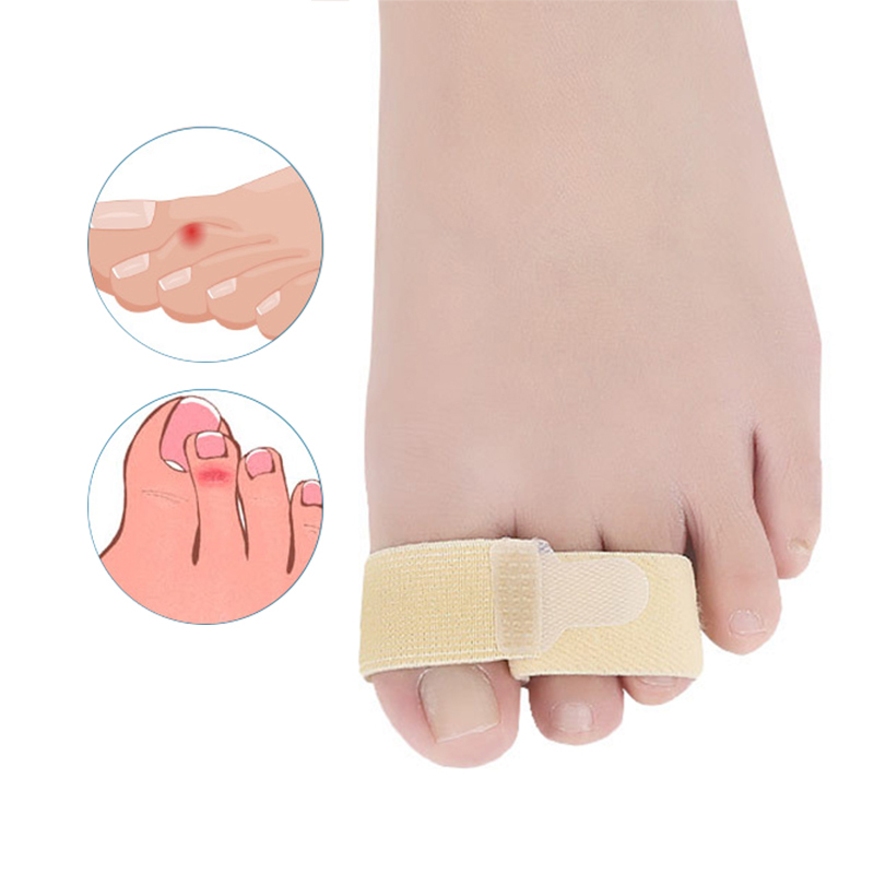 Pexmen 1/2/5/10Pcs Hammer Toe Straightener Toe Splints Cushions Bandages for Correcting Crooked & Overlapping Toes Protector: VIOLET/紫罗兰