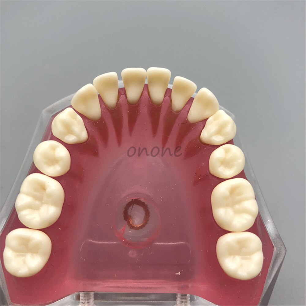 Dental Standard Model with Removable Teeth Dental Study Teach Teeth Model