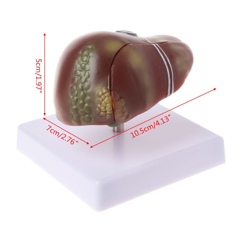 modelo anatómico patológico del hígado humano anatomía escuela enseñanza médica herramienta de visualización equipo de laboratorio