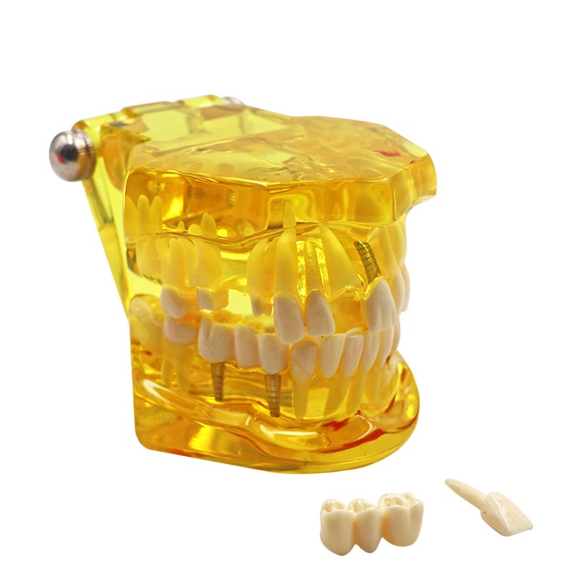 Modèle de dent multicolore, 1 pièce, modèle Standard d&#39;enseignement et d&#39;apprentissage dentaire pour adultes, utilisé dans les cliniques de stomatologie et de recherche