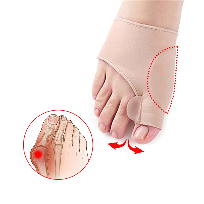 2 Stuks Grote Bot Orthopedische Bunion Correctie Pedicure Sokken Siliconen Hallux Valgus Corrector Bretels Tenen Separator Voetverzorging Tool