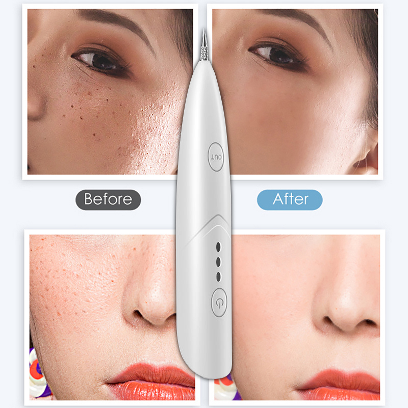 Mini Remove Nevus Pen Painless Freckles Blackhead Blemish Removers Pen Stick Skin Care Home Beauty Devices Instrument