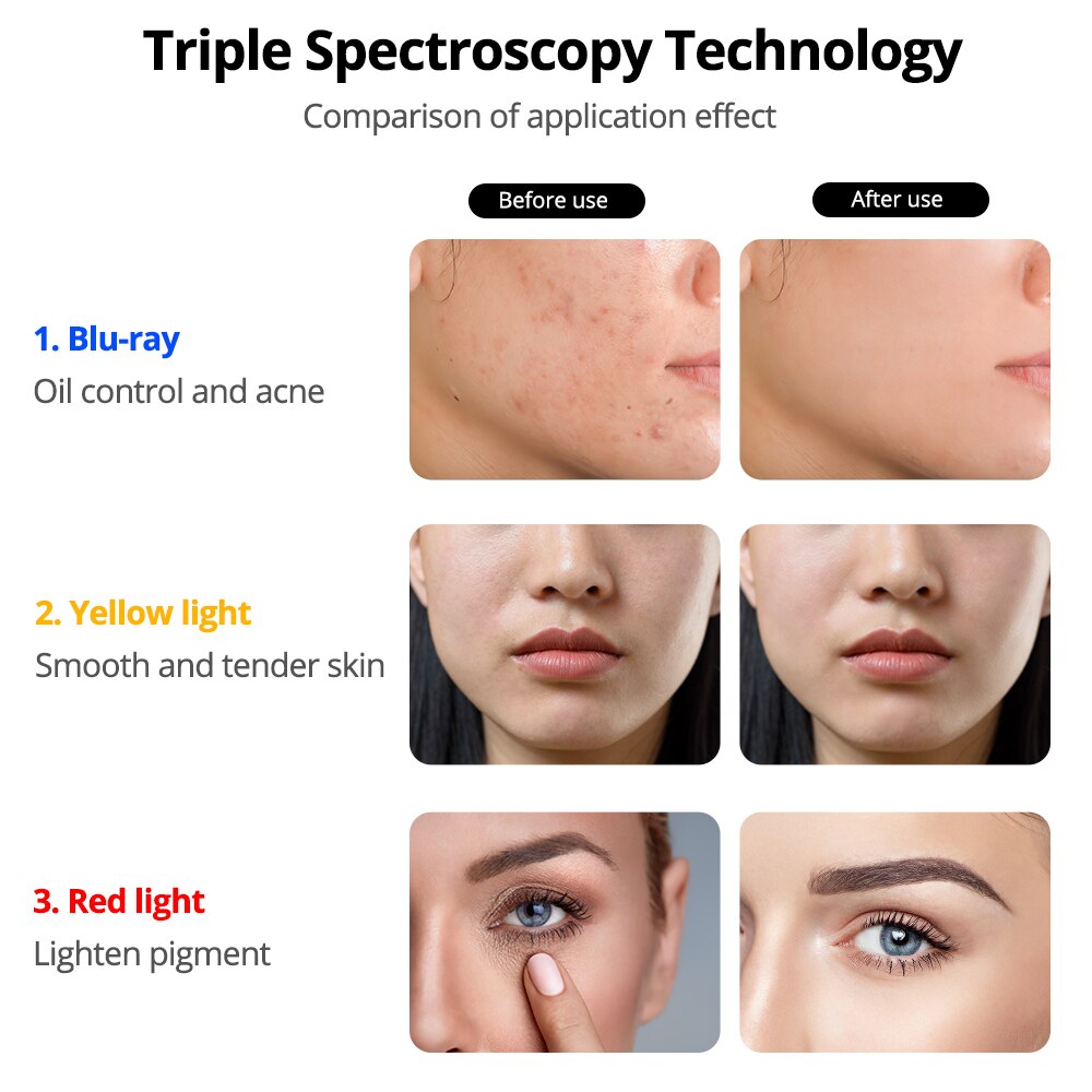 DIOZO Light 3 Colors Led Facial Mask Women Face Beauty Face Care Led Mask Therapy Light Whitening Firming Skin Wrinkle Removal