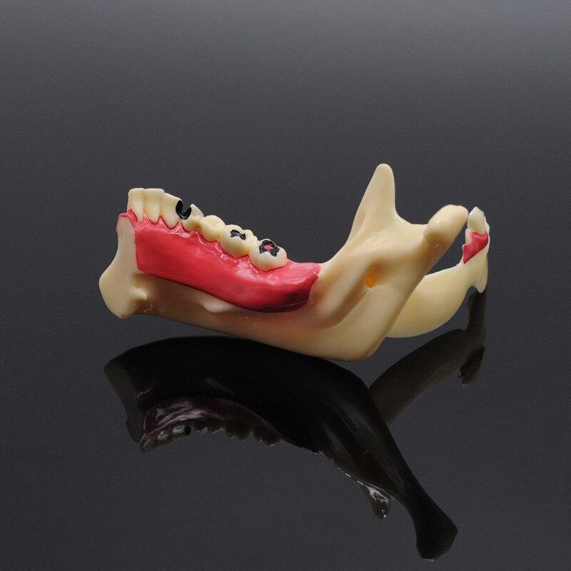 Tandpleje undervisning uddannelse model dental kommunikation model mandibular model