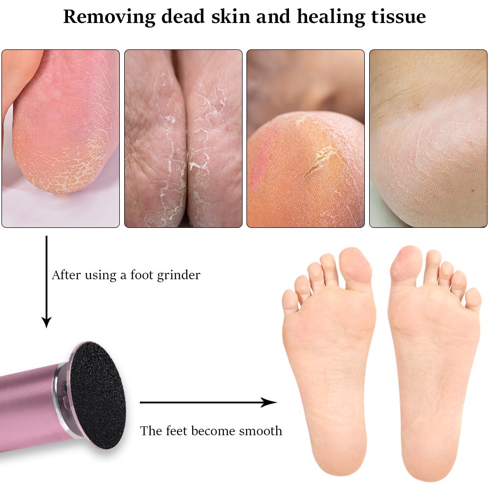 Electric Foot Care Pedicure Tools Files Pedicure Callus Remover Rechargeable Sawing File For Feet Dead Skin Callus Peel Remover