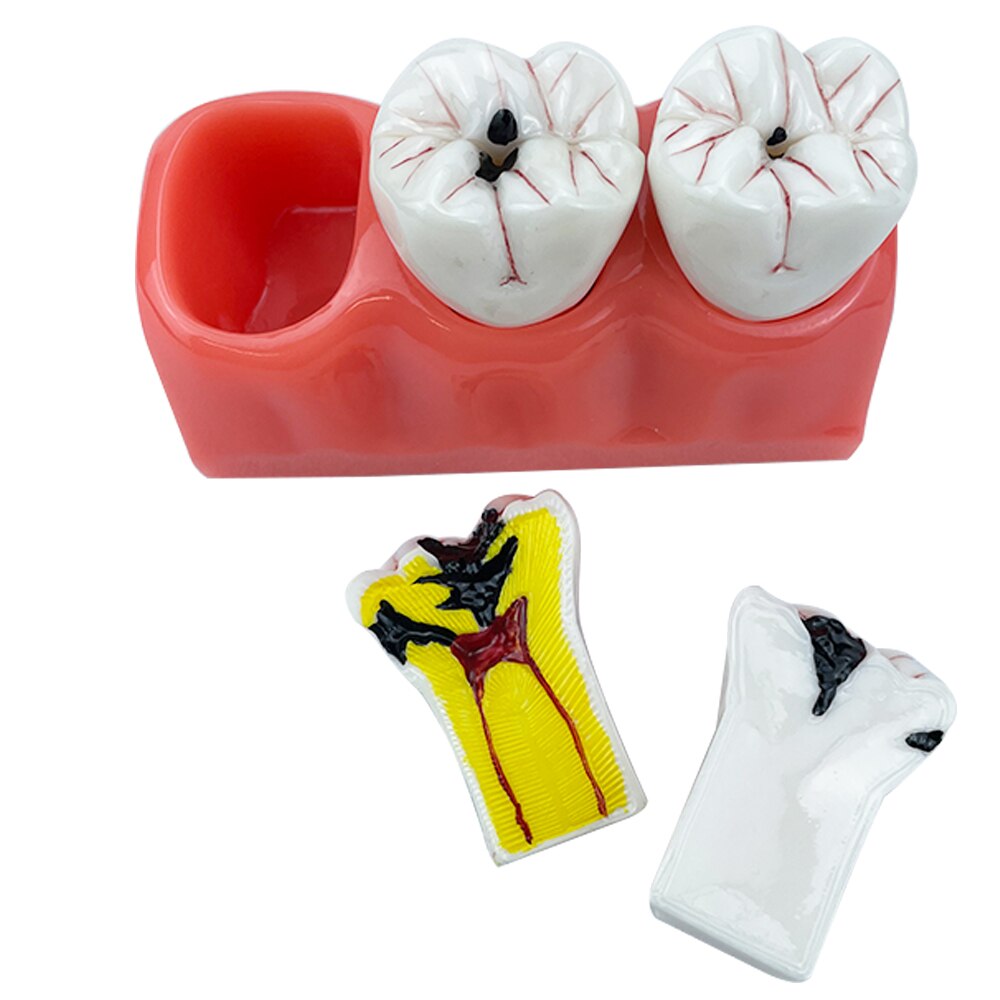 Dental Model Sold On United States