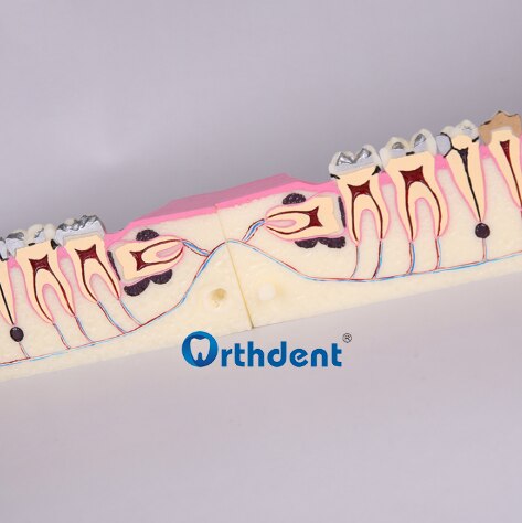 Dental Disease Teeth Anatomy Study Model Molar Cross Section Model