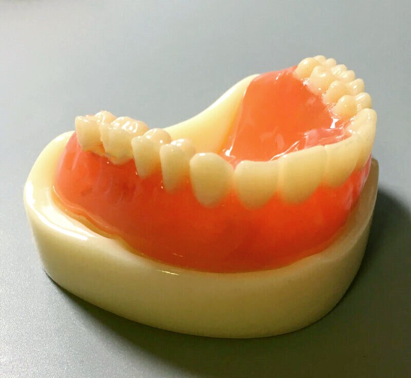 Modelo de dentadura completa Dental, accesorio magnético, estudio superior de la Mandibular