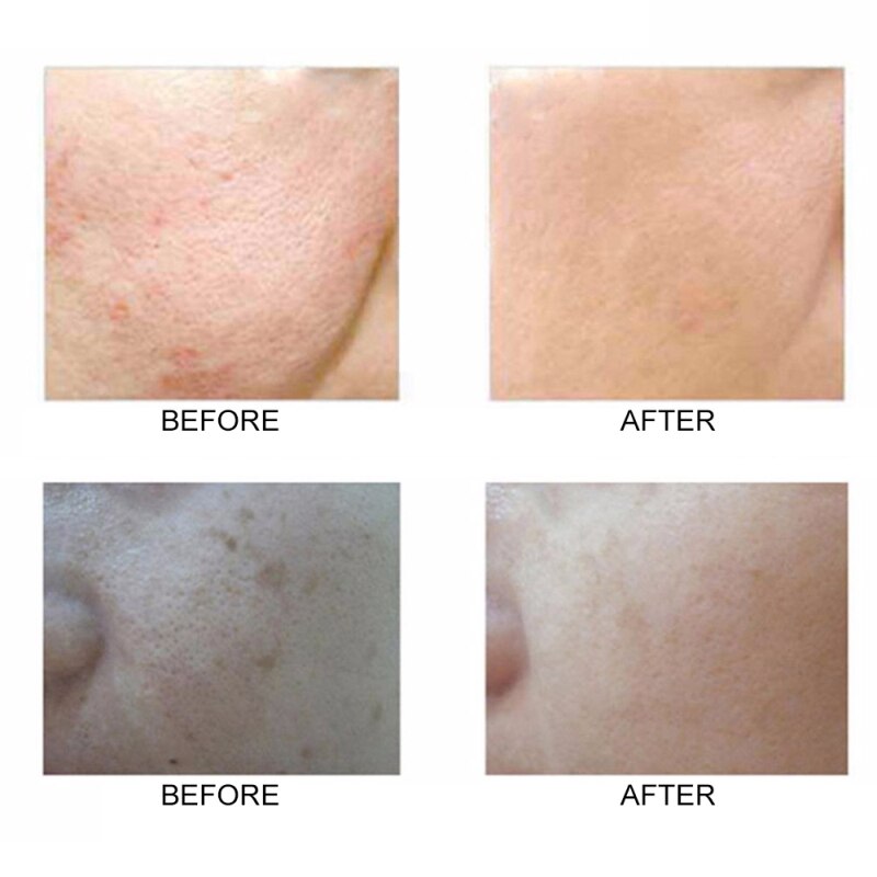 Brosse de nettoyage du visage en Silicone Double Face Portable, Massage du visage, en Fiber