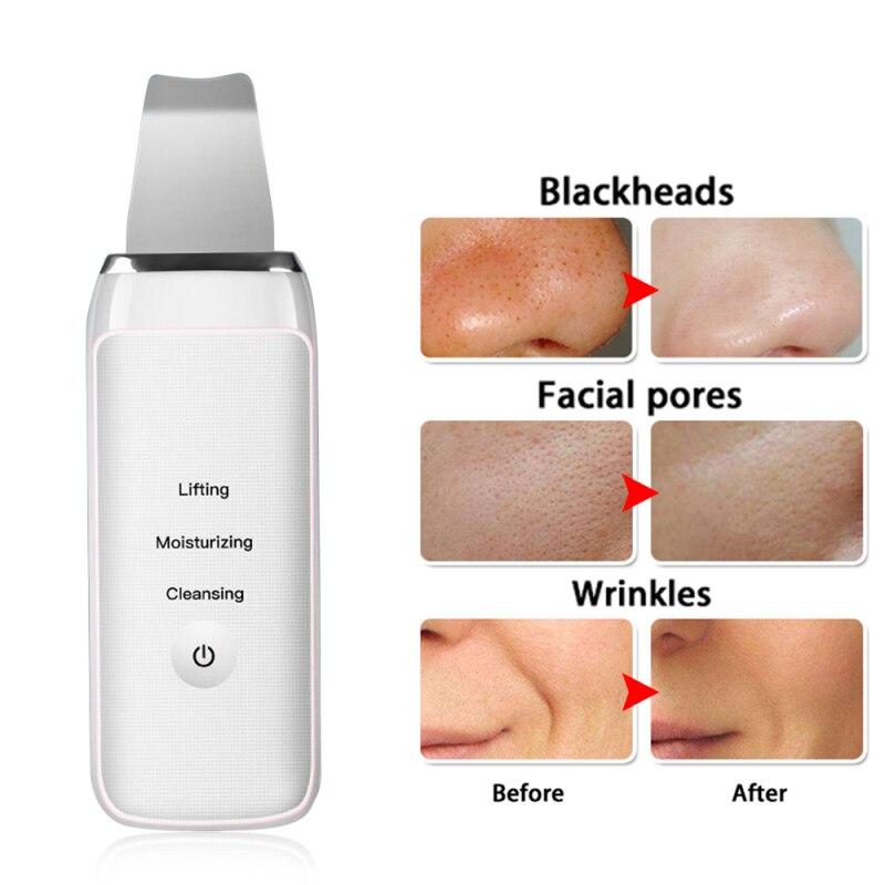 Skin Scrubber Facial Skin Scrubber USB Gentle Blackhead Remover Ultrasonic Reduce Wrinkles and spot Facial Dead Skin Removal 30D