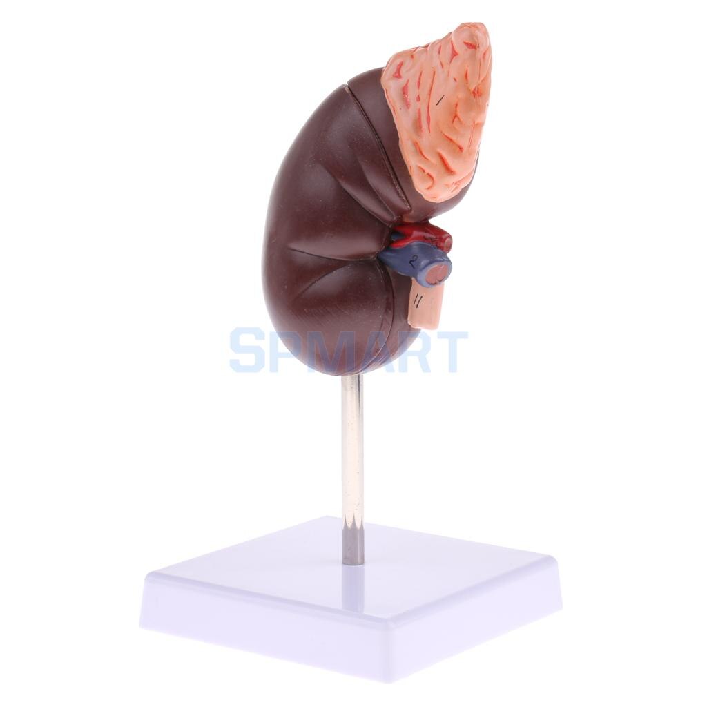 1:1 Menschliches Abnehmbare 2 Teile Niere mit Nebennieren Drüse Anatomisches Modell