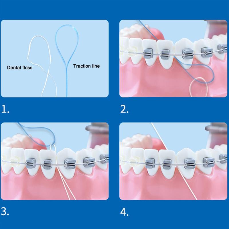 35 count tandtråd trädare för ortodontisk tandställning med implantat hängslen fodral broar förvaring fungerar med  h4 n 5